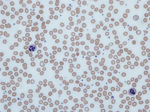 Stains help us see human blood cells under a microscope. The red blood cells pictured here are from an anemic blood sample. (Image courtesy of Dr Graham Beards, CC BY-SA 3.0, via Wikimedia Commons)